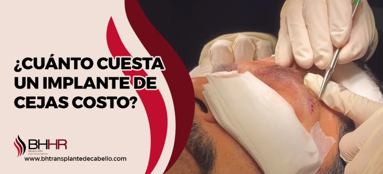 implante de cejas costo