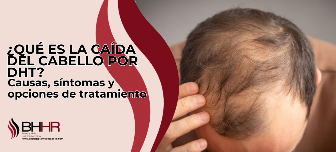 ¿Que es la caida del cabello por DHT?