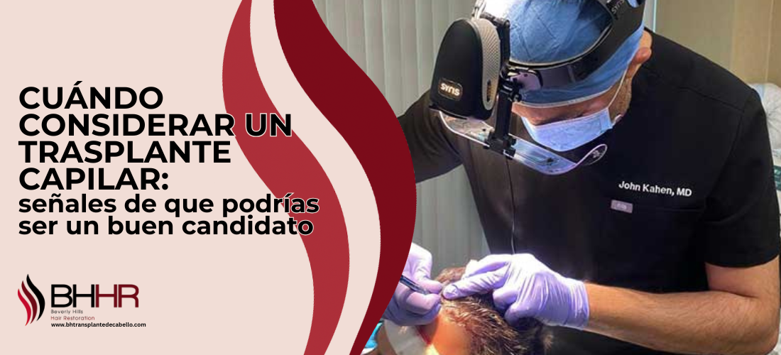 Cuando considerar un trasplante capilar