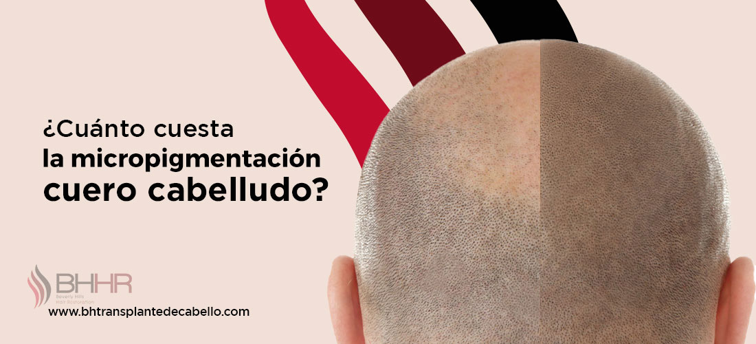 Micropigmentacion Capilar Precio