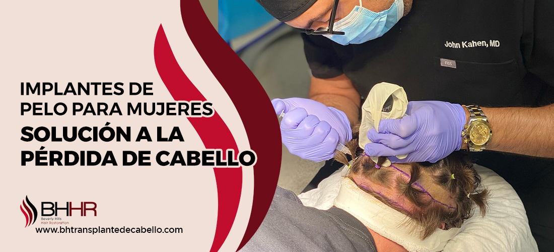 Implantes De Pelo Para Mujeres