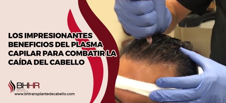 Beneficios Del Plasma Capilar