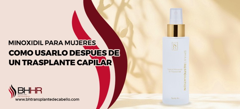 Minoxidil Para Mujeres