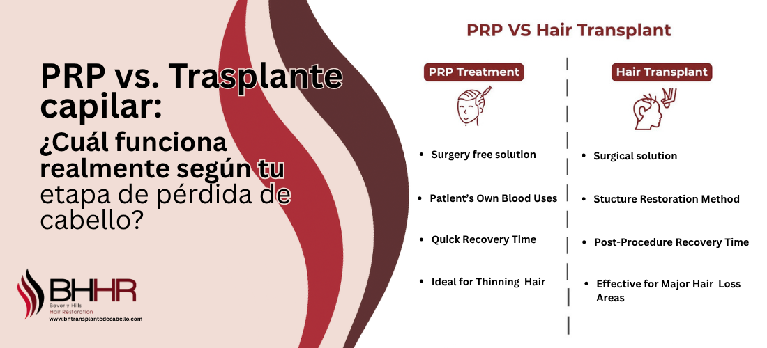 PRP vs. Trasplante capilar
