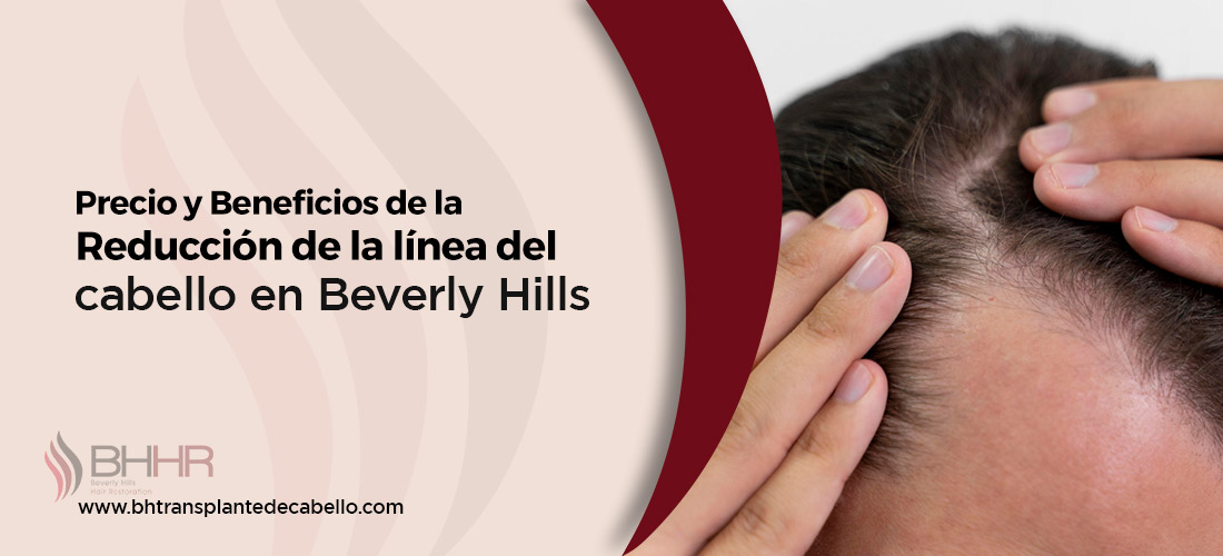 Reduccion de la linea del cabello
