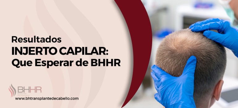 Resultados Injerto Capilar