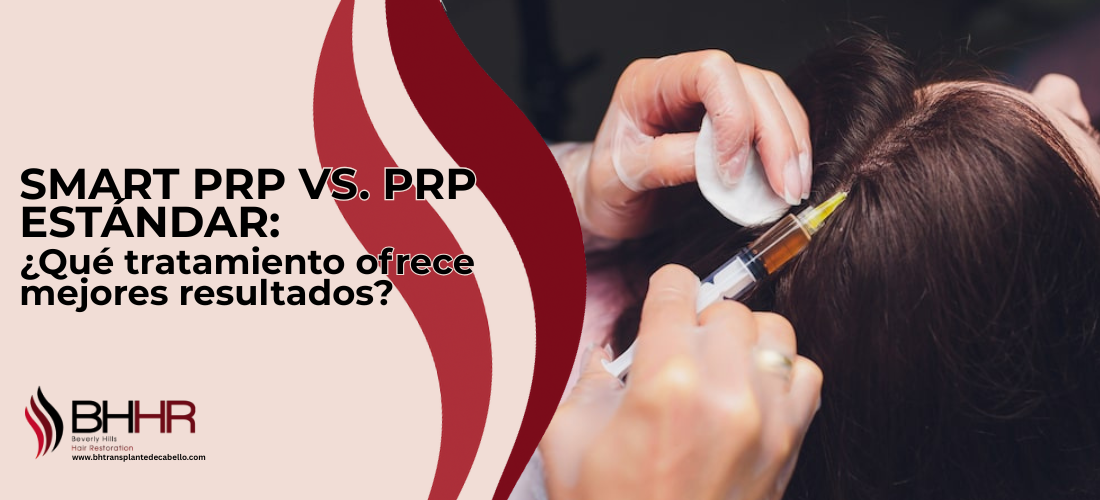 Smart PRP vs. PRP Estandar