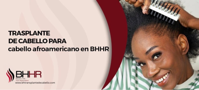 Injerto De Cabello Para Cabello Afroamericano