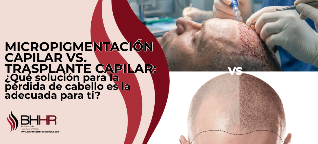 micropigmentacion capilar vs trasplante capilar