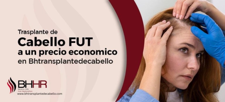 COSTO FUT EN TRASPLANTE